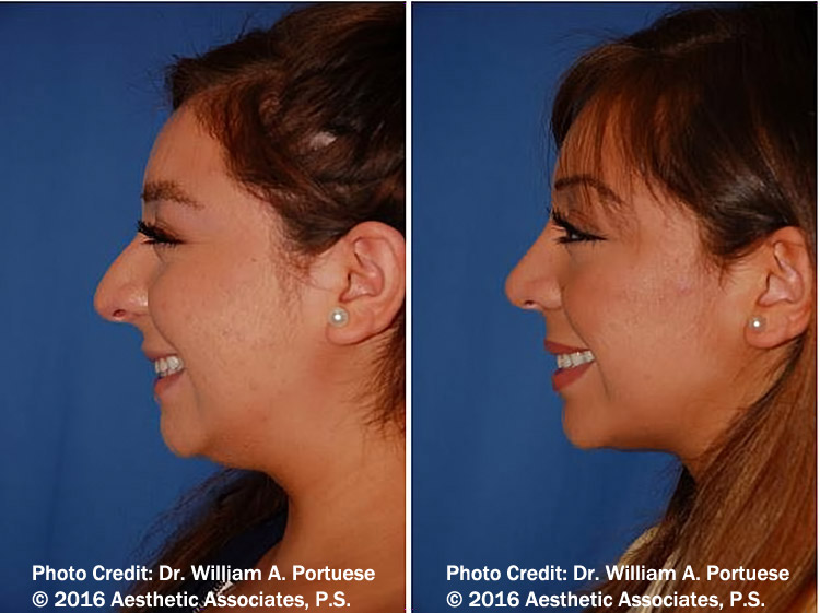 cosmetic surgery in seattle