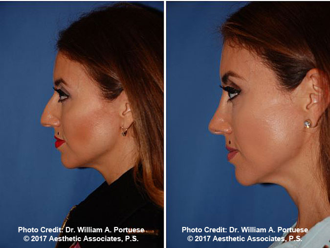 facial plastic surgeon in seattle