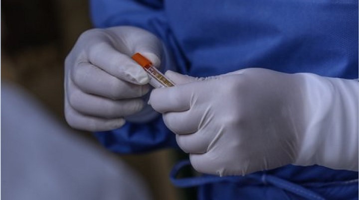 Ministerio de Salud reportó 486 casos nuevos de covid-19 en el Tolima