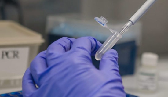 Tolima reporta 326 casos de covid-19 y 11 muertes más en el día de las velitas