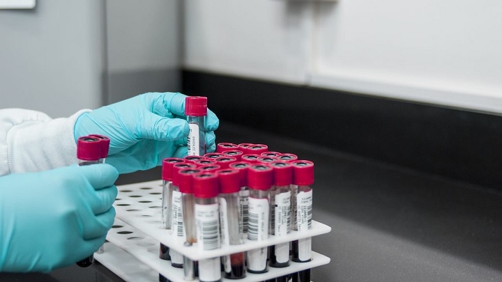 Se reportaron 102 casos de coronavirus en trece municipios del Tolima