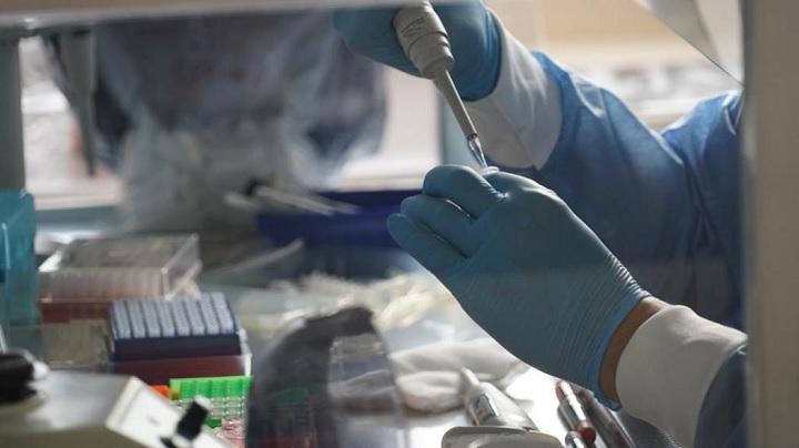 Covid-19 en el Tolima: cuatro muertes más y 172 contagios nuevos