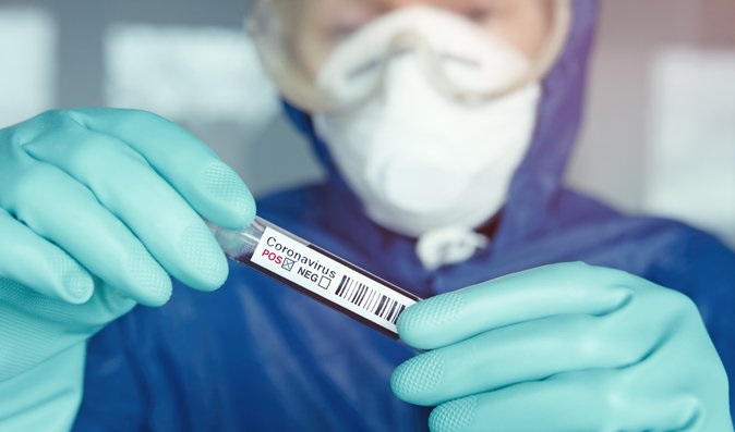 Preocupantes récords deja el covid-19 en el Tolima