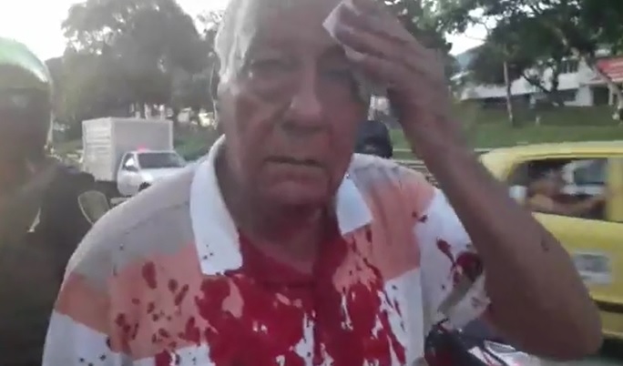 Padre del técnico Hernán Torres fue atacado por un limpiavidrios en Ibagué