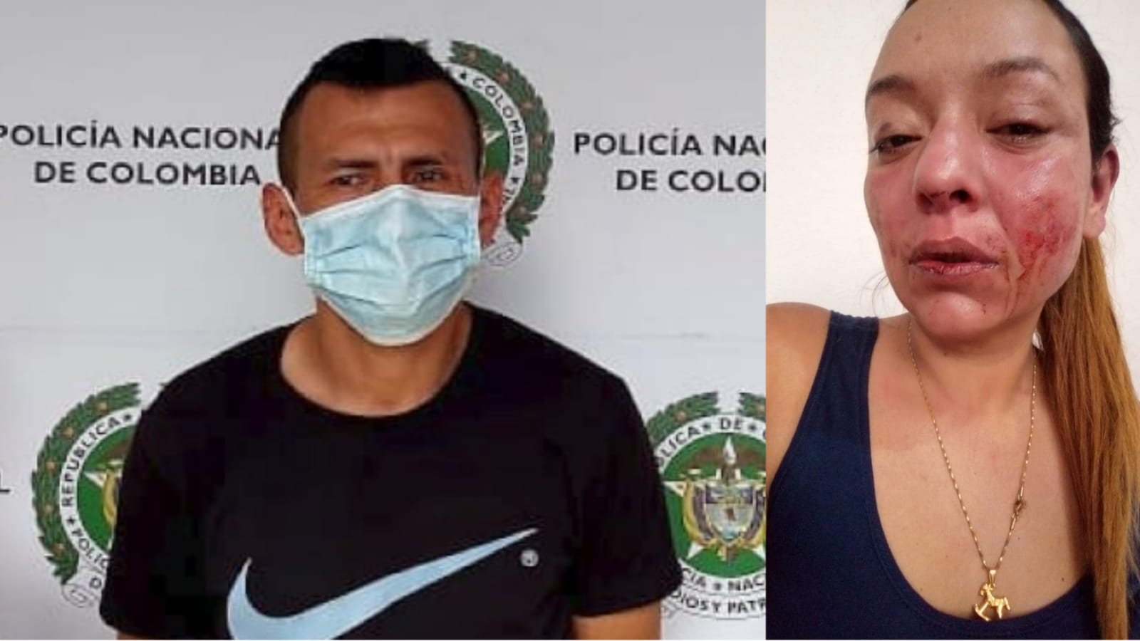 A la cárcel Jhony Olmos, sujeto que le propinó brutal golpiza a su expareja en Ibagué