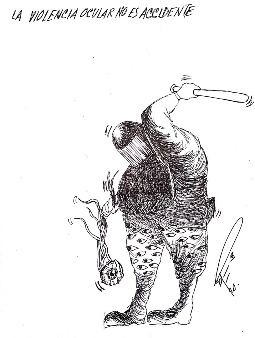 La violencia ocular no es accidente