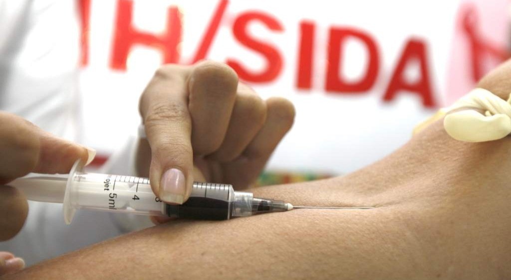 El Tolima con 265 casos nuevos de VIH – SIDA