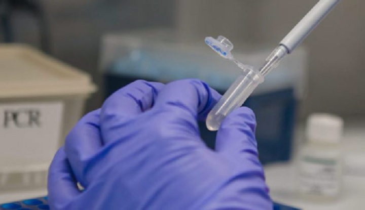 Tolima subió a 314 casos de coronavirus