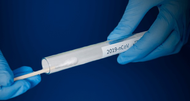 Tolima suma 421 casos nuevos y 14 muertes más por covid-19