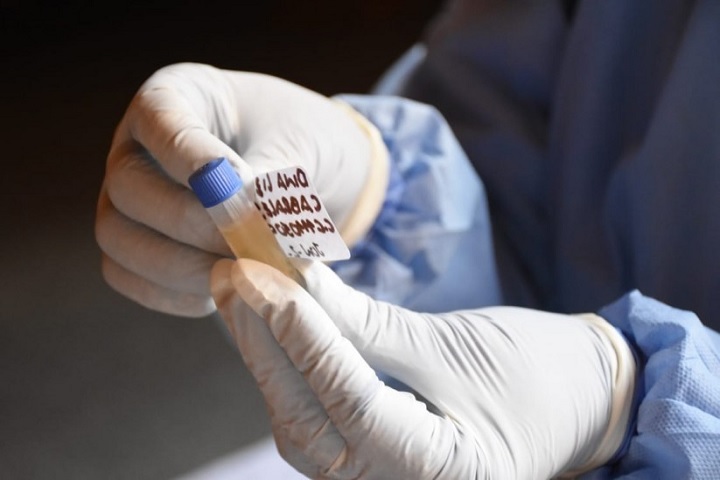 Preocupante repunte del covid-19 en Ibagué