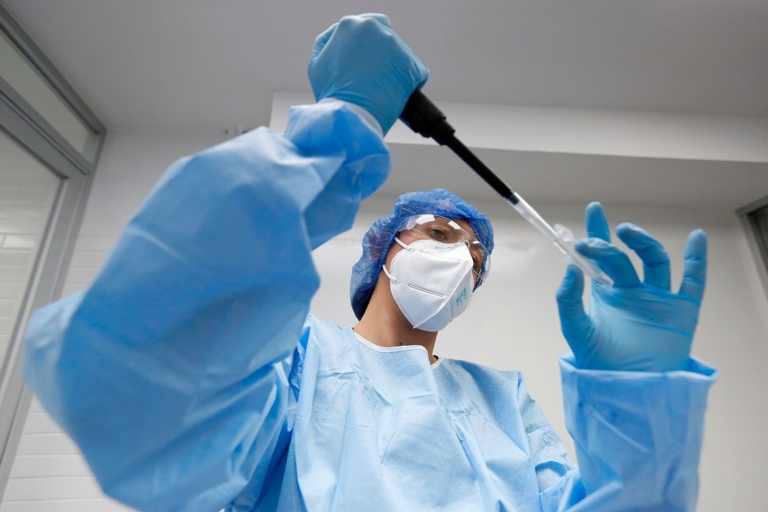 Hasta el momento, INS no confirma caso por viruela símica en el Tolima