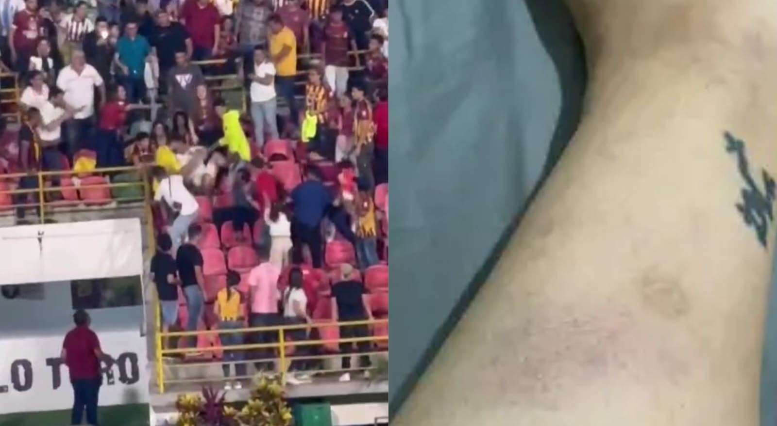 Hinchas del Deportes Tolima atacaron a familia de jugador tolimense de Patriotas