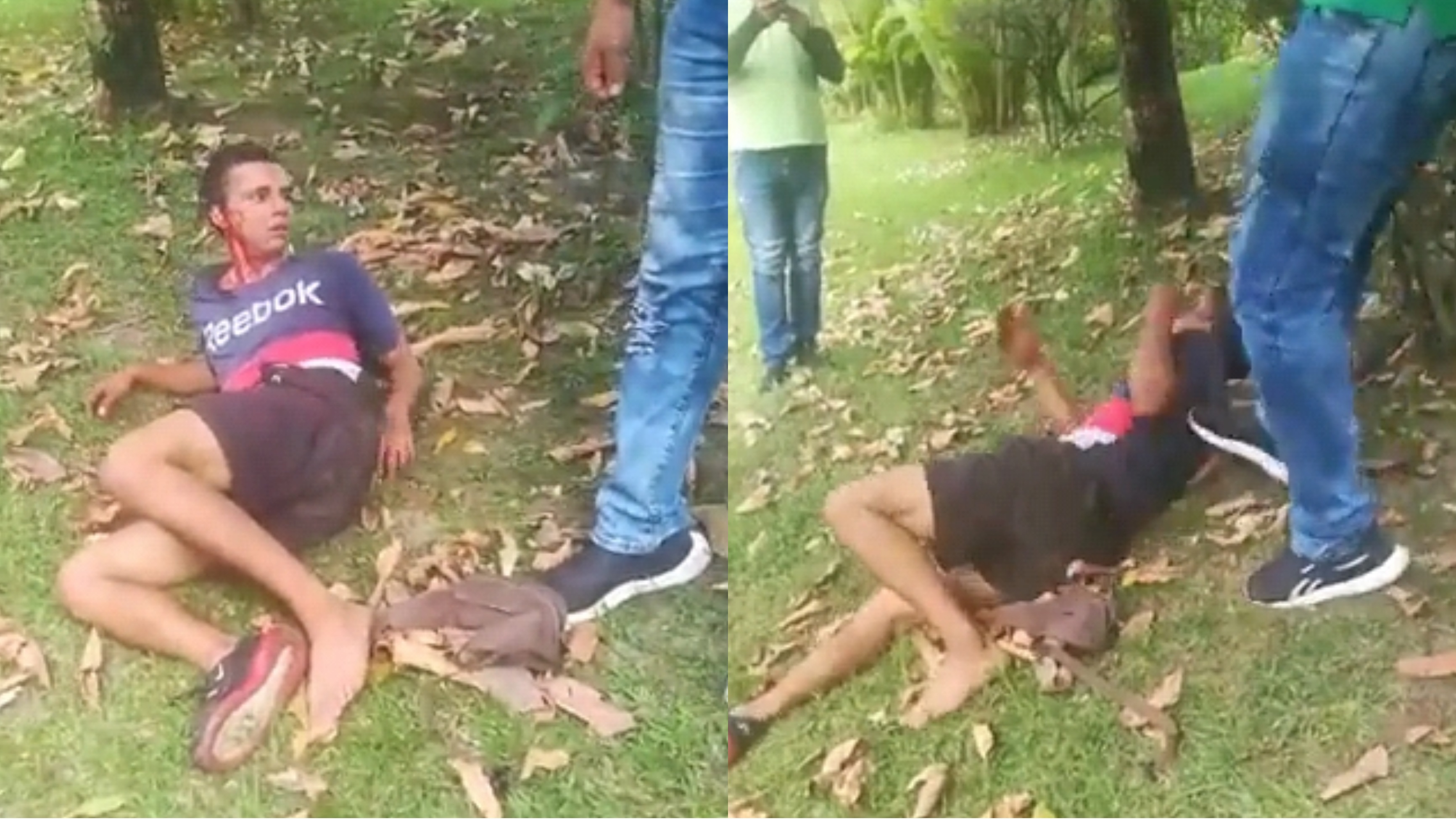 Fuerte golpiza a presunto ladrón capturado por la comunidad en Ibagué