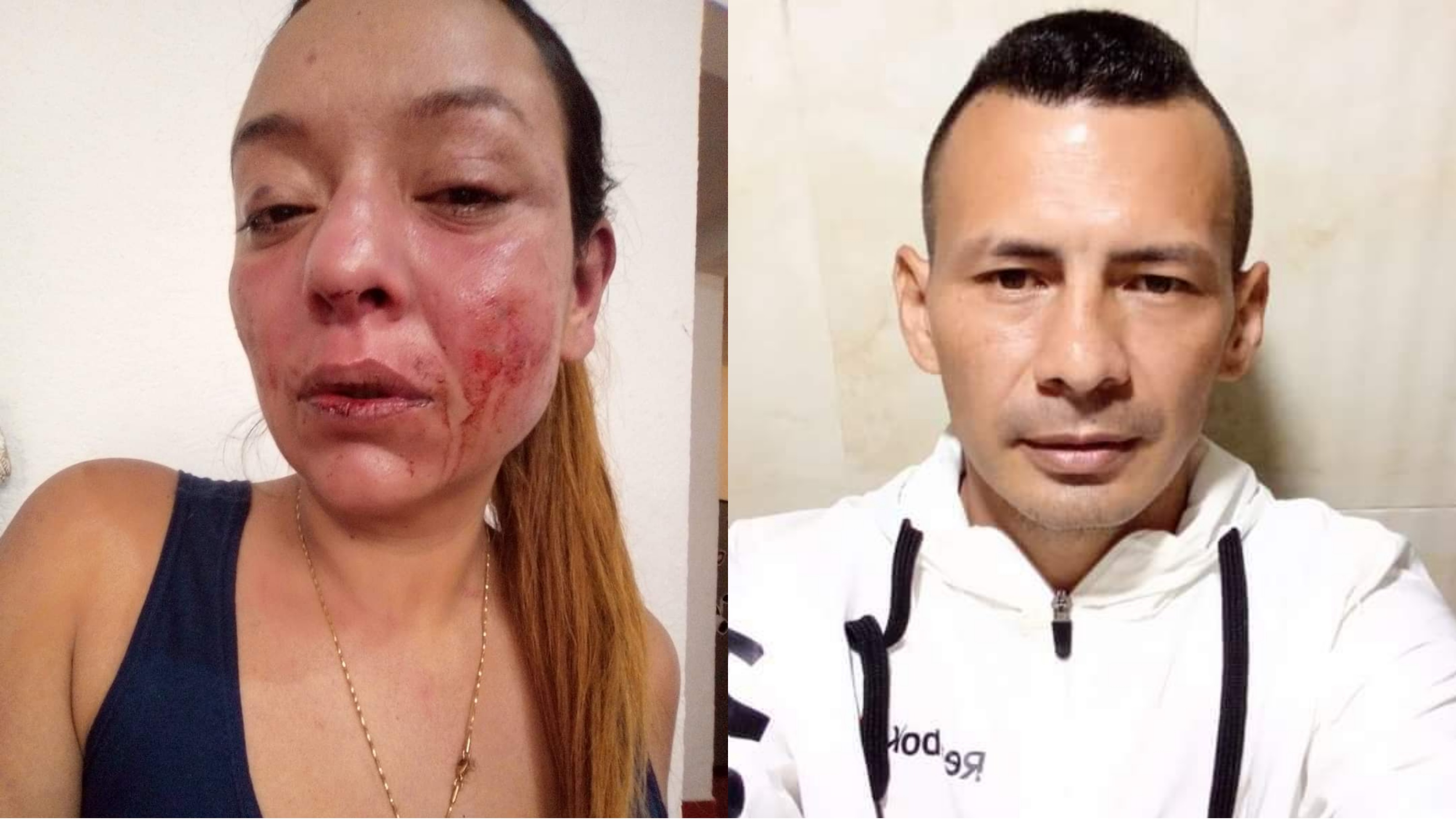 Mujer denuncia que sufrió brutal golpiza de su expareja en Ibagué