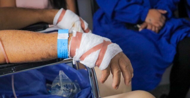 No se aprende. Van 56 quemados por pólvora en el Tolima