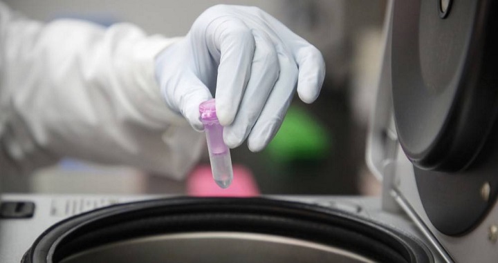 Ibagué llega a 802 casos positivos de covid-19: INS