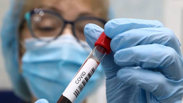 Colombia superó los 77.000 casos de coronavirus y el Tolima los 700