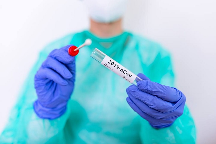 Este sábado confirman nueve muertes más por covid-19 en el Tolima