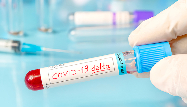 ¿Variante Delta llegó a Ibagué?