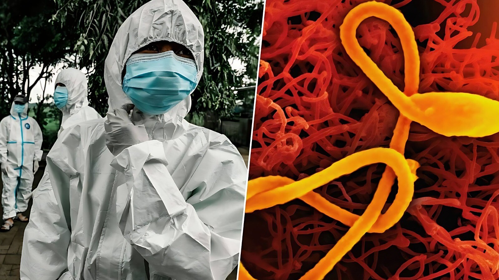 Alerta global por variante de Ébola: Colombia intensifica la vigilancia
