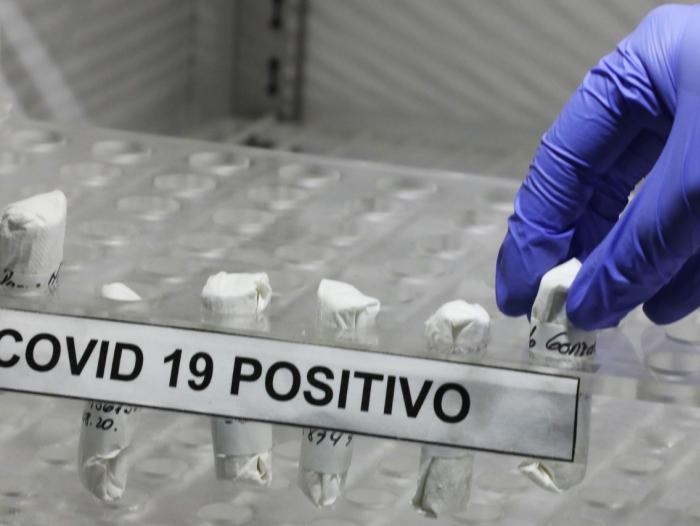 Reportan 260 casos nuevos de Covid-19 en el Tolima; tres muertes más en Ibagué