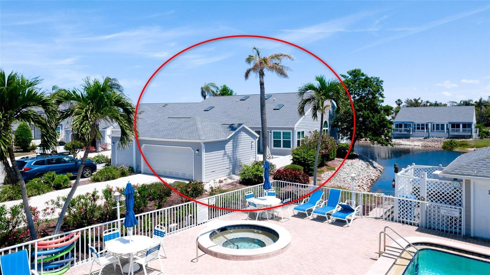 1011 IBIS CT