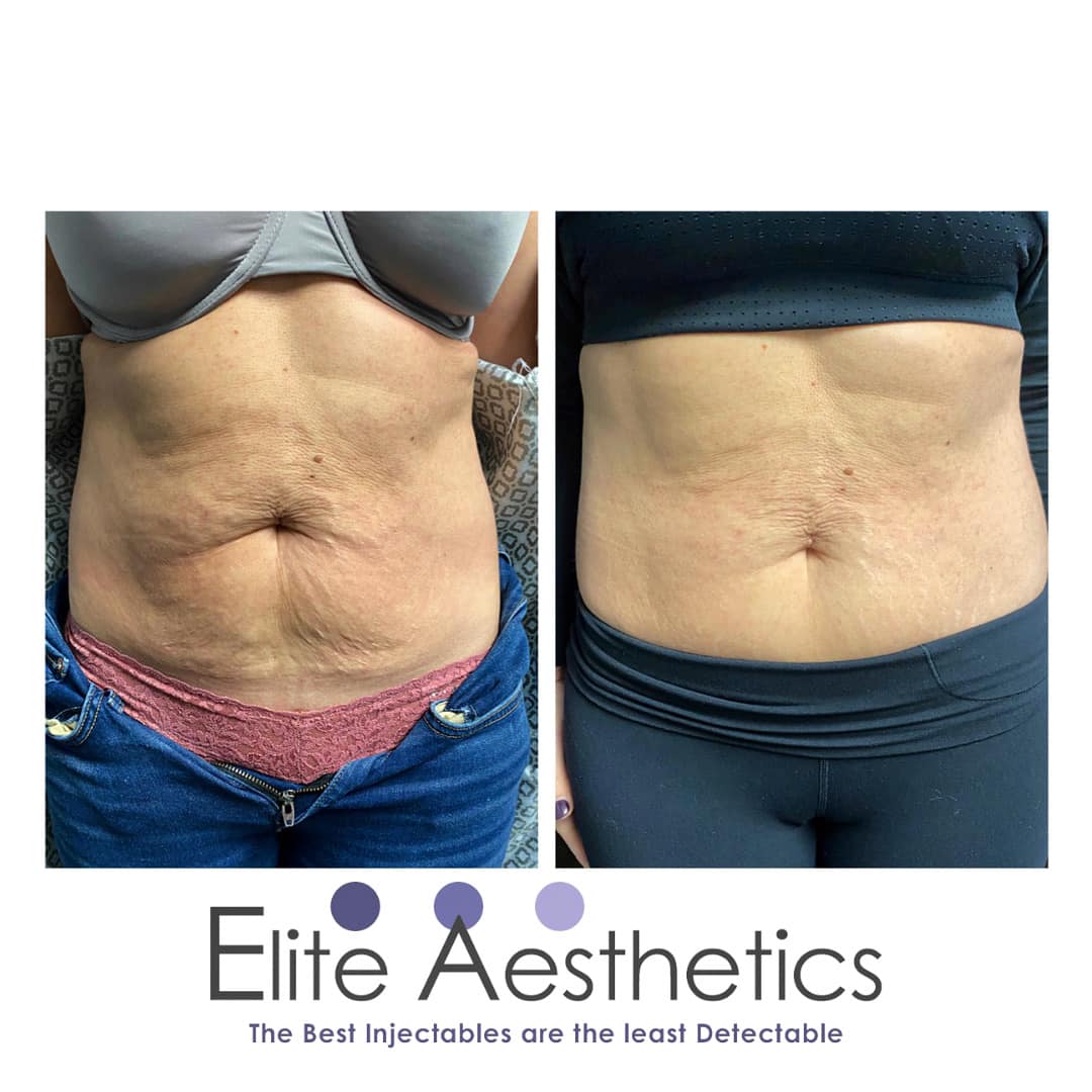 How can I grow my medical spa?