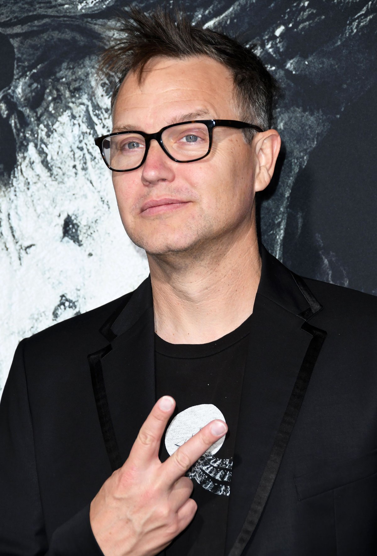 Does Mark Hoppus Have Genital Herpes? 7 Does Mark Hoppus Have Genital Herpes?