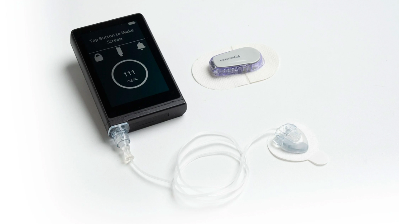 the-u-s-food-and-drug-administration-clears-a-new-artificial-pancreas