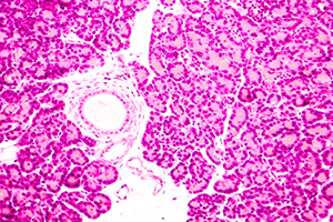 Pancreatic Islet Cells