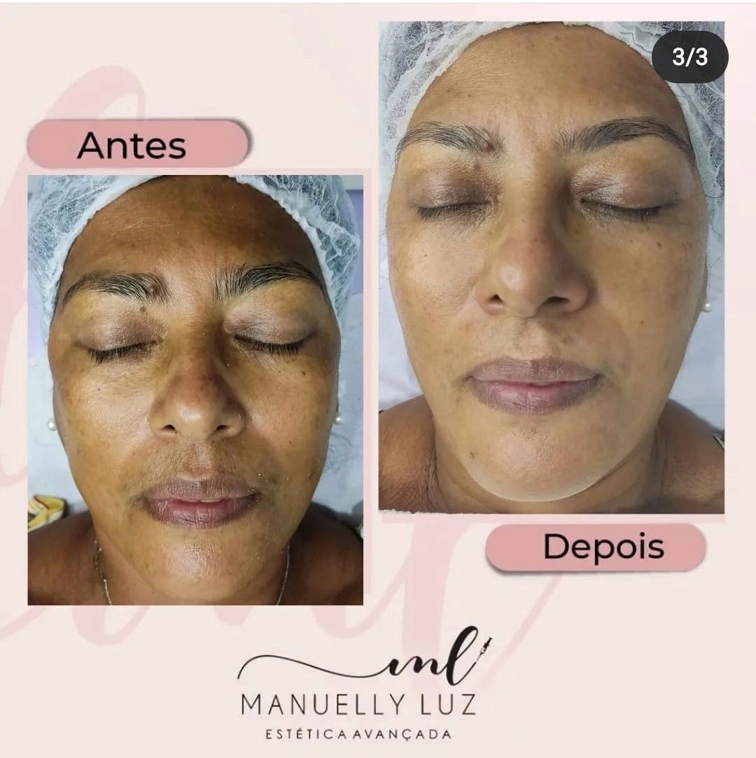 Consulta Online Estética 