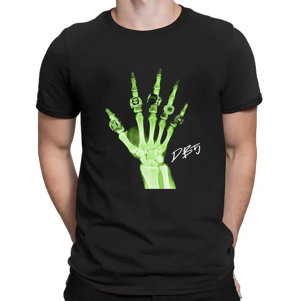 Patient 5 Damon Karma Barlow metacarpals t shirt